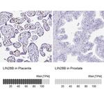 LIN28B Antibody