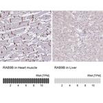 RAB9B Antibody in Immunohistochemistry (IHC)