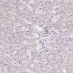 RAB9B Antibody in Immunohistochemistry (IHC)