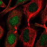 CHMP1B Antibody in Immunocytochemistry (ICC/IF)