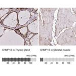 CHMP1B Antibody