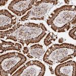 STOML2 Antibody in Immunohistochemistry (IHC)