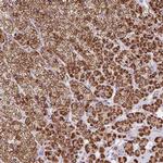 FDX1 Antibody in Immunohistochemistry (IHC)