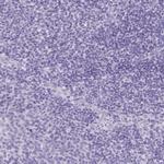 PNLIP Antibody in Immunohistochemistry (IHC)