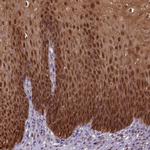 S100A2 Antibody in Immunohistochemistry (IHC)