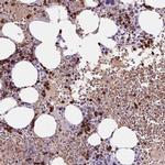 HBQ1 Antibody in Immunohistochemistry (IHC)