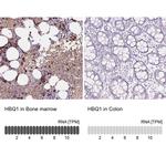 HBQ1 Antibody