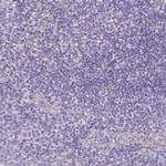 PNLIP Antibody in Immunohistochemistry (IHC)