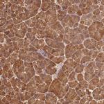 PNLIP Antibody in Immunohistochemistry (IHC)