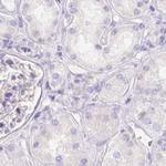 PNLIP Antibody in Immunohistochemistry (IHC)