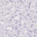 PNLIP Antibody in Immunohistochemistry (IHC)