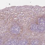 SBSN Antibody in Immunohistochemistry (IHC)