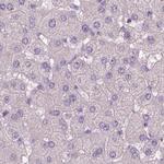 SBSN Antibody in Immunohistochemistry (IHC)