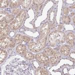 RSL24D1 Antibody in Immunohistochemistry (IHC)