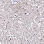 RSL24D1 Antibody in Immunohistochemistry (IHC)