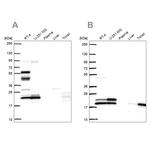 RSL24D1 Antibody in Western Blot (WB)