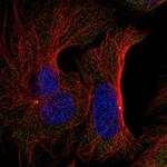 FNTB Antibody in Immunocytochemistry (ICC/IF)