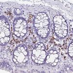 FNTB Antibody in Immunohistochemistry (IHC)