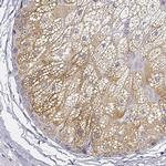 AWAT2 Antibody in Immunohistochemistry (IHC)