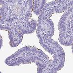 ODF3B Antibody in Immunohistochemistry (IHC)