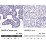 ODF3B Antibody