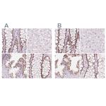 HOXB13 Antibody in Immunohistochemistry (IHC)