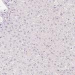 HOXB13 Antibody in Immunohistochemistry (IHC)