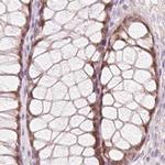 HOXB13 Antibody in Immunohistochemistry (IHC)