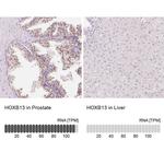 HOXB13 Antibody