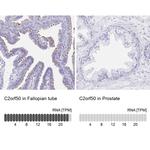 C2orf50 Antibody in Immunohistochemistry (IHC)