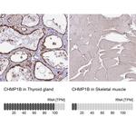 CHMP1B Antibody in Immunohistochemistry (IHC)