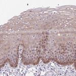 TAX1BP3 Antibody in Immunohistochemistry (IHC)