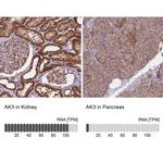 Adenylate Kinase 3 Antibody in Immunohistochemistry (IHC)