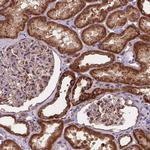 Adenylate Kinase 3 Antibody in Immunohistochemistry (IHC)