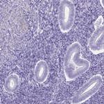 C11orf42 Antibody in Immunohistochemistry (IHC)