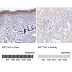 KRTDAP Antibody in Immunohistochemistry (IHC)