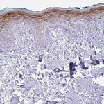 KRTDAP Antibody in Immunohistochemistry (IHC)