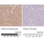 SH3GL2 Antibody in Immunohistochemistry (IHC)