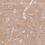 SH3GL2 Antibody in Immunohistochemistry (IHC)