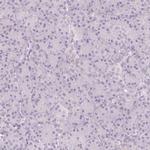 SH3GL2 Antibody in Immunohistochemistry (IHC)