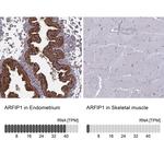 Arfaptin 1 Antibody in Immunohistochemistry (IHC)