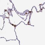 MARCO Antibody in Immunohistochemistry (IHC)