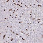 MARCO Antibody in Immunohistochemistry (IHC)