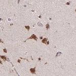 GOLGA5 Antibody in Immunohistochemistry (IHC)