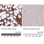 SLC4A1 Antibody in Immunohistochemistry (IHC)
