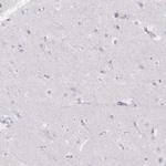 PRG3 Antibody in Immunohistochemistry (IHC)