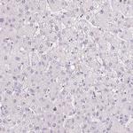 GALNT7 Antibody in Immunohistochemistry (IHC)