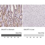 GALNT7 Antibody