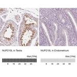 NUP210L Antibody