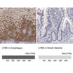 LY6D Antibody